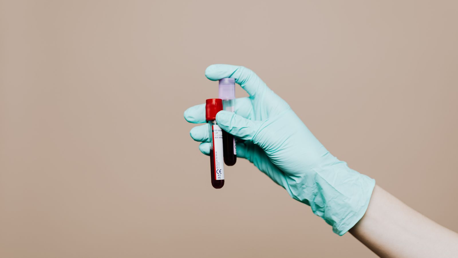 Close-up of a gloved hand holding blood test tubes against a neutral background.